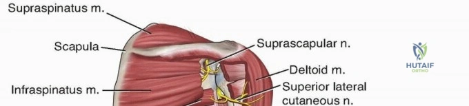 Illustration 2 for Enhance Recovery: Humeral Plate Fixation for Brachialis & Brachioradialis