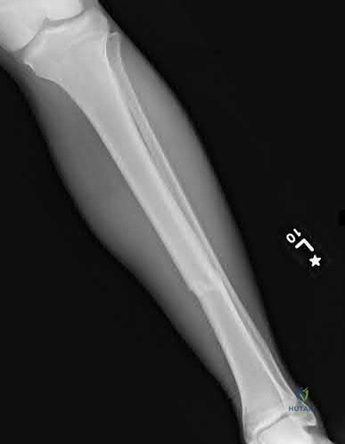 Illustration 219 for OrthoCash: Trauma MCQs & Cases for a yearold woman