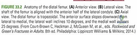Illustration 3 for Decoding Distal Femur Fractu