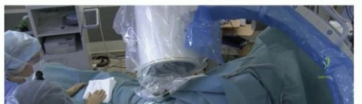 Illustration 9 for Optimize Twopart Surgical Neck Fracture Fixation with IM Nailing