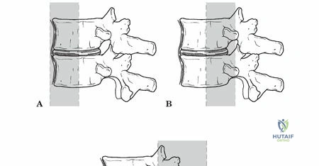 Illustration of Denis Three-Column Model