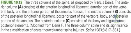 Lateral view detailing anatomical columns