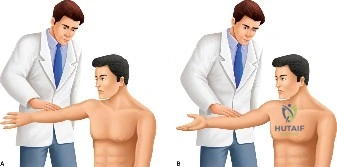 Illustration of cases slap tear - Dr. Mohammed Hutaif