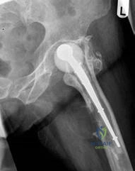 Illustration 3 for Structured Hip Oral: Master This Exam Question & Case