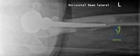 Illustration 2 for Structured Hip Oral: Master This Exam Question & Case