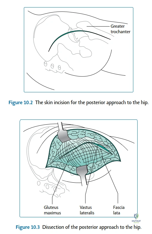 Clinical Image