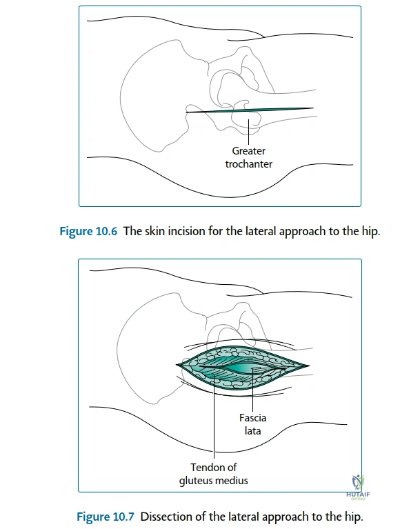 Clinical Image