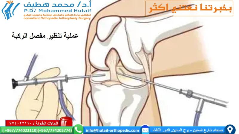 منظار الركبة بالصور