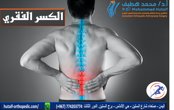 كسور الفقرات