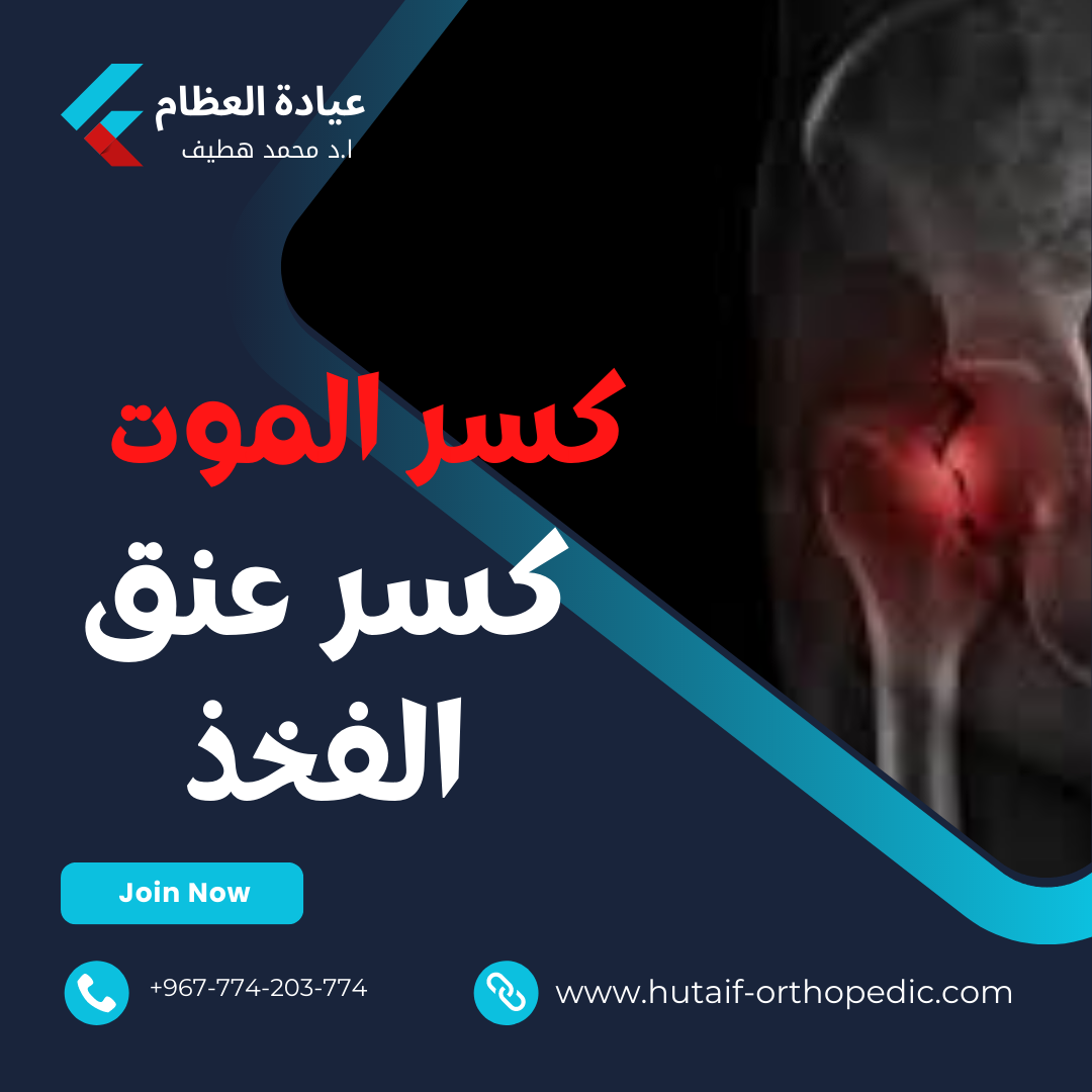 لماذا يسمى كسر عنق الفخذ بكسر الموت؟ إليكم كل ما تحتاجون معرفته عن هذا النوع الشائع من الكسور