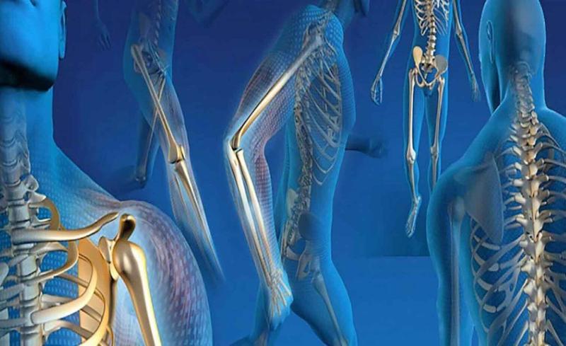 Should plates and screws be removed after bone fractures heal?