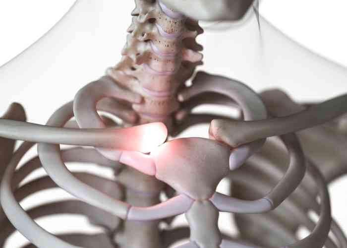 SternoClavicular Joint Injury: What You Need to Know