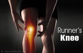 Runners Knee: What You Need to Know (2023)