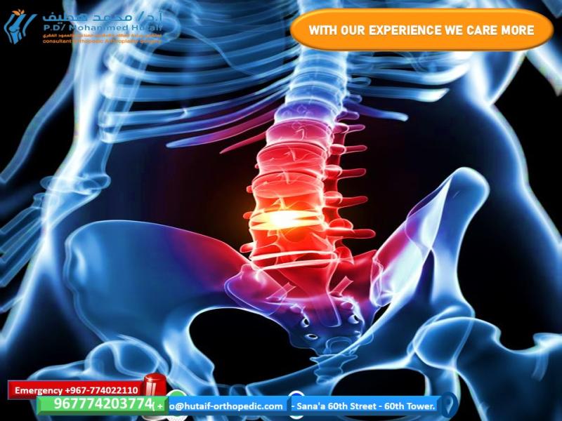 Herniated disc: Non-surgical treatment 