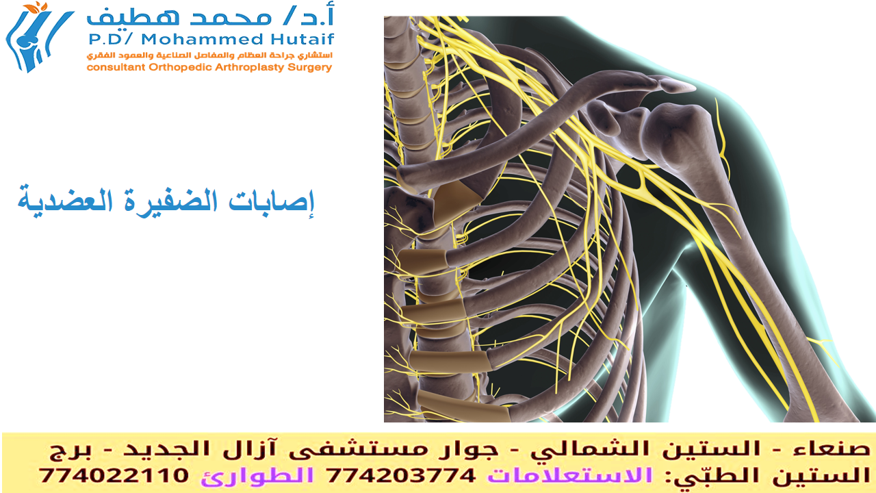إصابات الضفيرة العضدية