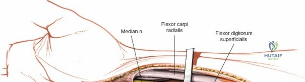 Clinical Image