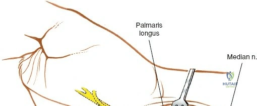 Clinical Image
