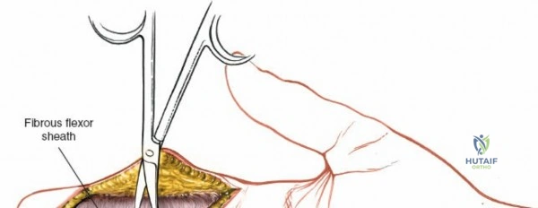 Clinical Image