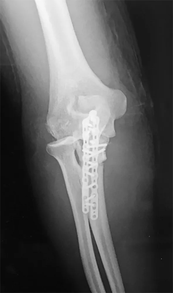 Orthopedic Board Review MCQs (2026 Edition) - Part 2