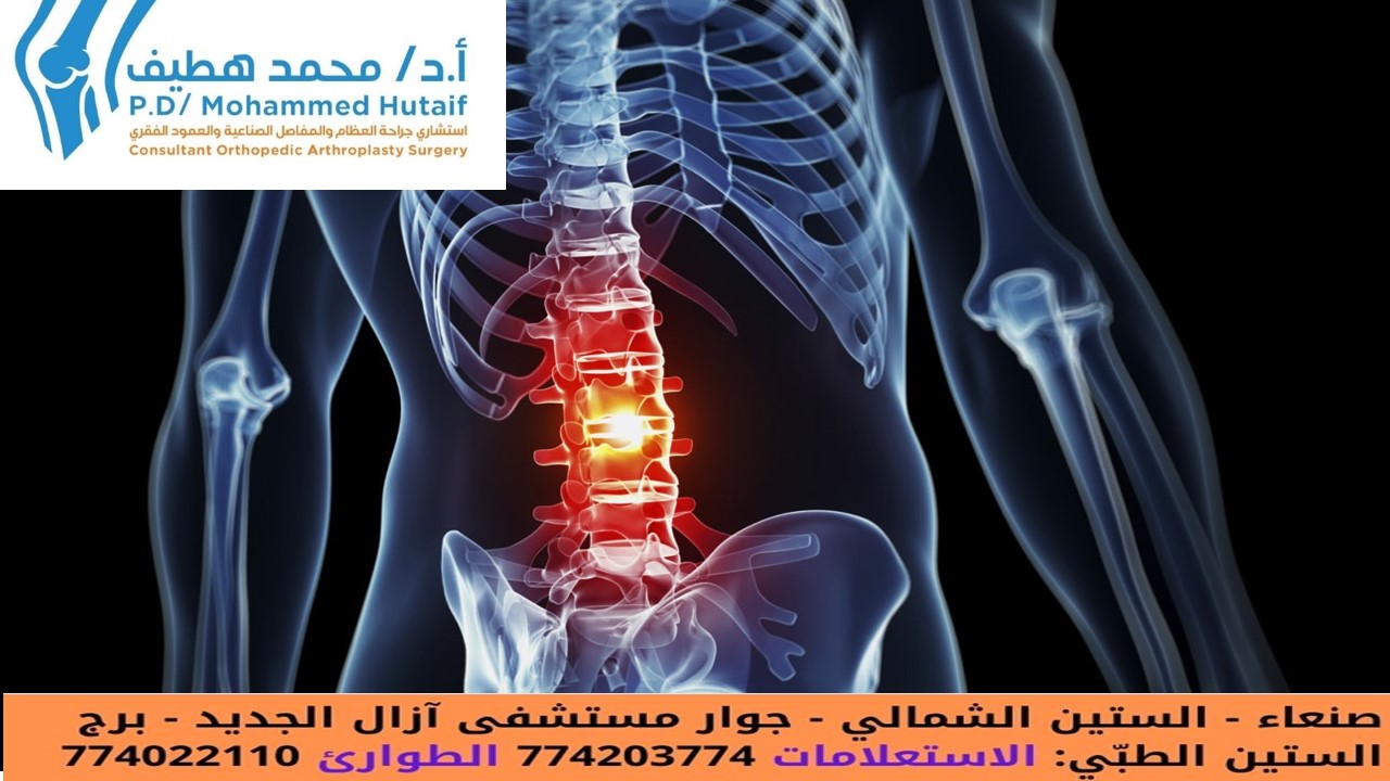 مشاكل العمود الفقري