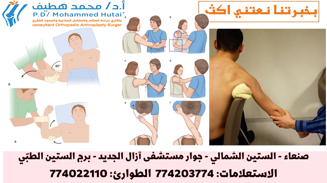 خلع الكتف -العلاج ماذا تفعل عند الإصابة بخلع في الكتف اذهب إلى  أقرب قسم للحوادث والطوارئ على الفور إذا كنت تعتقد أنك قد أصبت بخلع في كتفك.  أثناء انتظارك للعناية الطبية: لا تحرك المفصل. جبيرة أو حمالة مفصل الكتف في وضعه الحالي.  لا تحاول تحريك الكتف أو إجباره على العودة إلى مكانه. يمكن أن يؤدي ذلك إلى تلف مفصل الكتف والعضلات أو الأربطة أو الأعصاب أو الأوعية الدموية المحيطة به. ضع ثلجًا على المفصل المصاب. يمكن أن يساعد وضع الثلج على كتفك في تقليل الألم والتورم عن طريق التحكم في النزيف الداخلي وتراكم السوائل في مفصل الكتف وحوله.  كيف يتم علاج خلع الكتف سيتم تقييمك وفحصك عندما تصل إلى الطوارئ. ستخضع عادةً  للأشعة السينية  للتحقق مما إذا كنت قد كسرت أي عظام وتأكيد الخلع.  إذا كان لديك كسر ، فقد يكون لديك المزيد من الفحوصات لفحص المنطقة بمزيد من التفاصيل. تتطلب الكسور المصاحبة لخلع الكتف رعاية عظام متخصصة ، وقد تحتاج إلى جراحة.  إذا لم يكن لديك أي كسور ، فسيتم إعادة ذراعك بلطف مرة أخرى إلى مفصل الكتف باستخدام إجراء يعرف باسم التخفيض. الإرجاع  الإرجاع ستحصل على مسكنات للألم وقد يُعرض عليك دواء لمساعدتك على الاسترخاء (مهدئ).  عادة ما يتم إجراء الإرجاع في الطوارئ ، ولكن في بعض الأحيان يتم إجراؤه في غرفة العمليات تحت  التخدير العام بواسطة فريق تقويم العظام.  أثناء جلوسك على السرير ، يقوم الطبيب بتدوير ذراعك حول مفصل الكتف حتى يعود إلى مكانه. قد يستغرق هذا بضع دقائق.  سيكون لديك عادة أشعة سينية أخرى للتحقق من أن كتفك في الموضع الصحيح بمجرد عودة مفصل الكتف إلى مكانه.  إصلاح التمزقات في أنسجة الكتف يمزق بعض الأشخاص الأربطة والأوتار والأنسجة الأخرى عند خلع الكتف.  إذا تعرضت هذه الأنسجة للتلف ، فقد تحتاج إلى جراحة لإصلاحها. هذا يمكن أن يقلل بشكل كبير من فرصة خلع الكتف نفسه مرة أخرى في المستقبل لبعض الناس.  يتم إجراء الجراحة لإصلاح أنسجة الكتف تحت التخدير العام. يتم إجراؤها غالبًا باستخدام جراحة المنظار ، حيث يتم استخدام جروح صغيرة وأنبوب رفيع مزود بمصباح وكاميرا في أحد طرفيه (منظار المفصل) .  في بعض الأحيان يكون من الضروري إجراء عملية جراحية مفتوحة لتحريك العظام حول الكتف لمنع حدوث المزيد من الاضطرابات.  يمكن في بعض الأحيان تجنب الجراحة عن طريق القيام بتمارين مناسبة لتقوية الكتف إذا كانت الأنسجة مفرطة في التمدد ولكن لم تتمزق.  يتعافى من خلع في الكتف يمكنك عادةً العودة إلى المنزل بعد فترة وجيزة من إعادة كتفك إلى مكانه ، لكنك ستحتاج إلى إراحة ذراعك في حبال لبضعة أيام حتى يستقر الألم.  قد تحتاج إلى العودة إلى المستشفى لمتابعة الرعاية ، وقد تتم إحالتك أيضًا  للعلاج الطبيعي  لإعادة تأهيل كتفك وتقويتها.  تمارين الذراع والكتف قد يُنصح ببعض تمارين الذراع والكتف اللطيفة لممارستها في المنزل مع إخراج ذراعك من حبالها.  هذه سوف تساعد:  تقليل التيبس يخفف بعض الآلام بناء القوة في عضلات كتفك من المحتمل أن تشعر ببعض الألم أو عدم الراحة أو التمدد عند القيام بهذه التمارين. ومع ذلك ، إذا كنت تعاني من ألم شديد لأكثر من 30 دقيقة ، فقم بالتمرين بقوة أقل وبتكرار أقل.  مزيل للالم قد يكون كتفك مؤلمًا جدًا خلال الأيام القليلة الأولى في المنزل وقد تحتاج إلى تناول مسكنات الألم ، مثل الباراسيتامول أو الإيبوبروفين . اتبع دائمًا تعليمات الجرعة الموجودة على العبوة.  إذا لم يتحكم هذا في الألم ، يمكن أن يصف لك طبيبك مسكنًا أقوى للألم ، مثل الكوديين . يجب أن يهدأ الألم سريعًا إلى حد ما بمجرد إزالة القاذفة والبدء في تحريك كتفك.  وقت الانتعاش يمكنك التوقف عن ارتداء القاذفة بعد بضعة أيام ، لكن الأمر يستغرق حوالي 12 إلى 16 أسبوعًا للتعافي تمامًا من خلع الكتف.  ستتمكن عادةً من استئناف معظم الأنشطة في غضون أسبوعين ، ولكن يجب تجنب رفع الأثقال والرياضات التي تتضمن حركات الكتف لمدة تتراوح بين 6 أسابيع و 3 أشهر. سيقوم فريق الرعاية الخاص بك بتقديم المشورة لك.  من المحتمل أن تكون متوقفًا عن العمل لمدة 2 إلى 4 أسابيع ، أو أكثر ، إذا كان لديك عمل بدني. ناقش هذا مع فريق رعايتك.  إذا كنت قد كسرت ذراعك أو مفصل الكتف أيضًا ، فقد تحتاج إلى ارتداء المعلاق لمدة تصل إلى 6 أسابيع وسيستغرق التعافي وقتًا أطول.  خلع كتفك مرة أخرى تعتمد فرص خلع الكتف مرة أخرى على عمرك ومدى شفاء الأنسجة المحيطة بالمفصل في المرة الأولى.  يمكن أن يساعد إذا تم إصلاح أي أنسجة ممزقة جراحيًا بعد إعادة الكتف المخلوع إلى مكانه.  ومع ذلك ، تحدث الاضطرابات اللاحقة في بعض الأحيان ، خاصة عند الأشخاص الذين تقل أعمارهم عن 25 عامًا والذين تزيد أعمارهم عن 40 عامًا.  يمكن أن يؤدي القيام بتمارين التعافي بانتظام تحت إشراف أخصائي العلاج الطبيعي وتجنب وضعيات الذراع المحرجة إلى تقليل خطر حدوث خلع في الكتف مرة أخرى.  آخر مراجعة للصفحة: 21 يناير 2020 موعد المراجعة التالي: 21 يناير