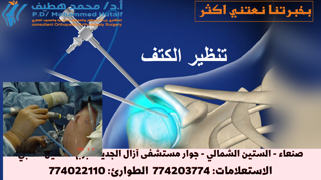 خلع الكتف -العلاج ماذا تفعل عند الإصابة بخلع في الكتف اذهب إلى  أقرب قسم للحوادث والطوارئ على الفور إذا كنت تعتقد أنك قد أصبت بخلع في كتفك.  أثناء انتظارك للعناية الطبية: لا تحرك المفصل. جبيرة أو حمالة مفصل الكتف في وضعه الحالي.  لا تحاول تحريك الكتف أو إجباره على العودة إلى مكانه. يمكن أن يؤدي ذلك إلى تلف مفصل الكتف والعضلات أو الأربطة أو الأعصاب أو الأوعية الدموية المحيطة به. ضع ثلجًا على المفصل المصاب. يمكن أن يساعد وضع الثلج على كتفك في تقليل الألم والتورم عن طريق التحكم في النزيف الداخلي وتراكم السوائل في مفصل الكتف وحوله.  كيف يتم علاج خلع الكتف سيتم تقييمك وفحصك عندما تصل إلى الطوارئ. ستخضع عادةً  للأشعة السينية  للتحقق مما إذا كنت قد كسرت أي عظام وتأكيد الخلع.  إذا كان لديك كسر ، فقد يكون لديك المزيد من الفحوصات لفحص المنطقة بمزيد من التفاصيل. تتطلب الكسور المصاحبة لخلع الكتف رعاية عظام متخصصة ، وقد تحتاج إلى جراحة.  إذا لم يكن لديك أي كسور ، فسيتم إعادة ذراعك بلطف مرة أخرى إلى مفصل الكتف باستخدام إجراء يعرف باسم التخفيض. الإرجاع  الإرجاع ستحصل على مسكنات للألم وقد يُعرض عليك دواء لمساعدتك على الاسترخاء (مهدئ).  عادة ما يتم إجراء الإرجاع في الطوارئ ، ولكن في بعض الأحيان يتم إجراؤه في غرفة العمليات تحت  التخدير العام بواسطة فريق تقويم العظام.  أثناء جلوسك على السرير ، يقوم الطبيب بتدوير ذراعك حول مفصل الكتف حتى يعود إلى مكانه. قد يستغرق هذا بضع دقائق.  سيكون لديك عادة أشعة سينية أخرى للتحقق من أن كتفك في الموضع الصحيح بمجرد عودة مفصل الكتف إلى مكانه.  إصلاح التمزقات في أنسجة الكتف يمزق بعض الأشخاص الأربطة والأوتار والأنسجة الأخرى عند خلع الكتف.  إذا تعرضت هذه الأنسجة للتلف ، فقد تحتاج إلى جراحة لإصلاحها. هذا يمكن أن يقلل بشكل كبير من فرصة خلع الكتف نفسه مرة أخرى في المستقبل لبعض الناس.  يتم إجراء الجراحة لإصلاح أنسجة الكتف تحت التخدير العام. يتم إجراؤها غالبًا باستخدام جراحة المنظار ، حيث يتم استخدام جروح صغيرة وأنبوب رفيع مزود بمصباح وكاميرا في أحد طرفيه (منظار المفصل) .  في بعض الأحيان يكون من الضروري إجراء عملية جراحية مفتوحة لتحريك العظام حول الكتف لمنع حدوث المزيد من الاضطرابات.  يمكن في بعض الأحيان تجنب الجراحة عن طريق القيام بتمارين مناسبة لتقوية الكتف إذا كانت الأنسجة مفرطة في التمدد ولكن لم تتمزق.  يتعافى من خلع في الكتف يمكنك عادةً العودة إلى المنزل بعد فترة وجيزة من إعادة كتفك إلى مكانه ، لكنك ستحتاج إلى إراحة ذراعك في حبال لبضعة أيام حتى يستقر الألم.  قد تحتاج إلى العودة إلى المستشفى لمتابعة الرعاية ، وقد تتم إحالتك أيضًا  للعلاج الطبيعي  لإعادة تأهيل كتفك وتقويتها.  تمارين الذراع والكتف قد يُنصح ببعض تمارين الذراع والكتف اللطيفة لممارستها في المنزل مع إخراج ذراعك من حبالها.  هذه سوف تساعد:  تقليل التيبس يخفف بعض الآلام بناء القوة في عضلات كتفك من المحتمل أن تشعر ببعض الألم أو عدم الراحة أو التمدد عند القيام بهذه التمارين. ومع ذلك ، إذا كنت تعاني من ألم شديد لأكثر من 30 دقيقة ، فقم بالتمرين بقوة أقل وبتكرار أقل.  مزيل للالم قد يكون كتفك مؤلمًا جدًا خلال الأيام القليلة الأولى في المنزل وقد تحتاج إلى تناول مسكنات الألم ، مثل الباراسيتامول أو الإيبوبروفين . اتبع دائمًا تعليمات الجرعة الموجودة على العبوة.  إذا لم يتحكم هذا في الألم ، يمكن أن يصف لك طبيبك مسكنًا أقوى للألم ، مثل الكوديين . يجب أن يهدأ الألم سريعًا إلى حد ما بمجرد إزالة القاذفة والبدء في تحريك كتفك.  وقت الانتعاش يمكنك التوقف عن ارتداء القاذفة بعد بضعة أيام ، لكن الأمر يستغرق حوالي 12 إلى 16 أسبوعًا للتعافي تمامًا من خلع الكتف.  ستتمكن عادةً من استئناف معظم الأنشطة في غضون أسبوعين ، ولكن يجب تجنب رفع الأثقال والرياضات التي تتضمن حركات الكتف لمدة تتراوح بين 6 أسابيع و 3 أشهر. سيقوم فريق الرعاية الخاص بك بتقديم المشورة لك.  من المحتمل أن تكون متوقفًا عن العمل لمدة 2 إلى 4 أسابيع ، أو أكثر ، إذا كان لديك عمل بدني. ناقش هذا مع فريق رعايتك.  إذا كنت قد كسرت ذراعك أو مفصل الكتف أيضًا ، فقد تحتاج إلى ارتداء المعلاق لمدة تصل إلى 6 أسابيع وسيستغرق التعافي وقتًا أطول.  خلع كتفك مرة أخرى تعتمد فرص خلع الكتف مرة أخرى على عمرك ومدى شفاء الأنسجة المحيطة بالمفصل في المرة الأولى.  يمكن أن يساعد إذا تم إصلاح أي أنسجة ممزقة جراحيًا بعد إعادة الكتف المخلوع إلى مكانه.  ومع ذلك ، تحدث الاضطرابات اللاحقة في بعض الأحيان ، خاصة عند الأشخاص الذين تقل أعمارهم عن 25 عامًا والذين تزيد أعمارهم عن 40 عامًا.  يمكن أن يؤدي القيام بتمارين التعافي بانتظام تحت إشراف أخصائي العلاج الطبيعي وتجنب وضعيات الذراع المحرجة إلى تقليل خطر حدوث خلع في الكتف مرة أخرى.  آخر مراجعة للصفحة: 21 يناير 2020 موعد المراجعة التالي: 21 يناير