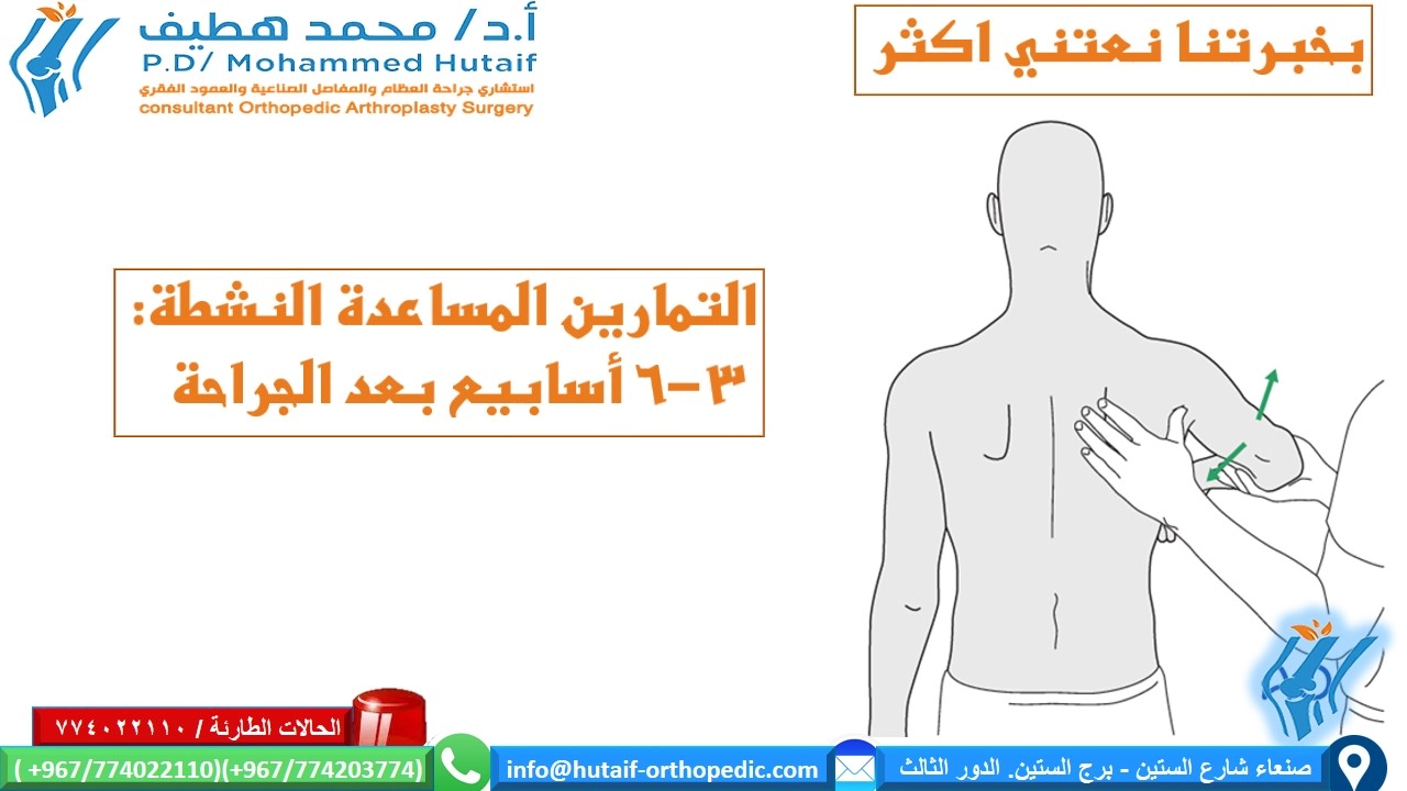العلاج غير الجراحي كسور راس عظم العضد القريبة يجب أن يوفر العلاج غير الجراحي دعمًا ميكانيكيًا لفترة حتى يشعر المريض بالراحة الكافية لبدء استخدام الكتف ، ويتم دمج الكسر بشكل كافٍ بحيث يكون الازاحة غير محتملة. بمجرد تحقيق هذه الأهداف ، يمكن أن تبدأ التدريبات التأهيلية في استعادة نطاق الحركة ، متبوعًا بالقوة والوظيفة. وهكذا تكون المراحل الثلاث للعلاج غير الجراحي 1) التثبيت 2) نطاق الحركة الخاملة / المساعدة 3) تمارين المقاومة التقدمية يجب أن تكون مدة التثبيت قصيرة قدر الإمكان وطويلة فترة الضرورة. عادة ، يوصى بالتثبيت لمدة 2-3 أسابيع ، متبوعًا بمجموعة لطيفة من تمارين الحركة. يمكن أن تبدأ تمارين المقاومة بشكل عام في الأسبوع السادس. قد تساعد تمارين متساوية القياس في الحفاظ على القوة خلال الأسابيع الستة الأولى. يتم تحقيق الاستقرار الأمثل للكتف عندما يتم تثبيت الجزء العلوي من الذراع والساعد في الصدر. تقليديا ، تم القيام بذلك باستخدام حبال تدعم الكوع والساعد وتتصدى لوزن الذراع. أبسط حبال هو ضمادة مثلثة مربوطة خلف الرقبة. يتم توفير دعم إضافي من خلال رقعة تلتف حول عظم العضد والصدر لتقييد حركة الكتف بشكل أكبر ، والحفاظ على الذراع بإحكام في الحمالة. توفر الأجهزة المتاحة تجاريًا تثبيتًا مشابهًا ، مع أو بدون دعم محيطي من قطعة قماش. توفر جميع هذه الأجهزة دعمًا مشابهًا بشكل أساسي لمفصل الكتف. أبسط دعامة للذراع هي ما يسمى بالياقة والكفة(طوق وكفة) التي تحد من حركة الكتف لكنها لا تدعم الكثير من وزن الذراع. قد يكون هذا مرغوبًا عندما يُتوقع أن يؤدي الجر اللطيف إلى تحسين محاذاة الكسر. توفر ثباتًا أقل من الرافعة ، مع أو بدون مسند ، ويجب إزالتها لحركة الكتف أو الكوع. يمكن ارتداء معظم دعامات الكتف أسفل ملابس المريض أو خارجها. يساعد إبقاء اليد في متناول اليد وتشجيع المريض على التحرك باستخدام الرسغ والأصابع ، على منع التصلب الذي قد يكون من الصعب جدًا تصحيحه إذا سمح له بالتطور يمكن علاج الإزاحة الطفيفة إلى المعتدلة لكسور العضد القريبة عن طريق الدعم الخارجي وحده. تعتبر علاقة الذراع العريضة هي الطريقة الأكثر شيوعا. في أبسط أشكالها ، يتم لف ضمادة مثلثة حول الكوع والساعد وربطها خلف الرقبة. يمكن ضبط الدعامات لتجنب الإزاحةفي الكتف الذي قد يسبب انحرافا غير مرغوب فيه. تتوفر الرافعات التجارية لتوفير دعم مماثل. لتخفيف التوتر على وتر فوق الشوكة و الحدبة الكبري ، يمكن للمرء أن يدعم الذراع في سادة تبعيد الكتف الي الخارج . يمكن القيام بذلك باستخدام ما يسمى جبيرة الطائرة أو وسادة تبعيد الكتف كما هو موضح. - الحركة: 2-3 أسابيع بعد الصدمة