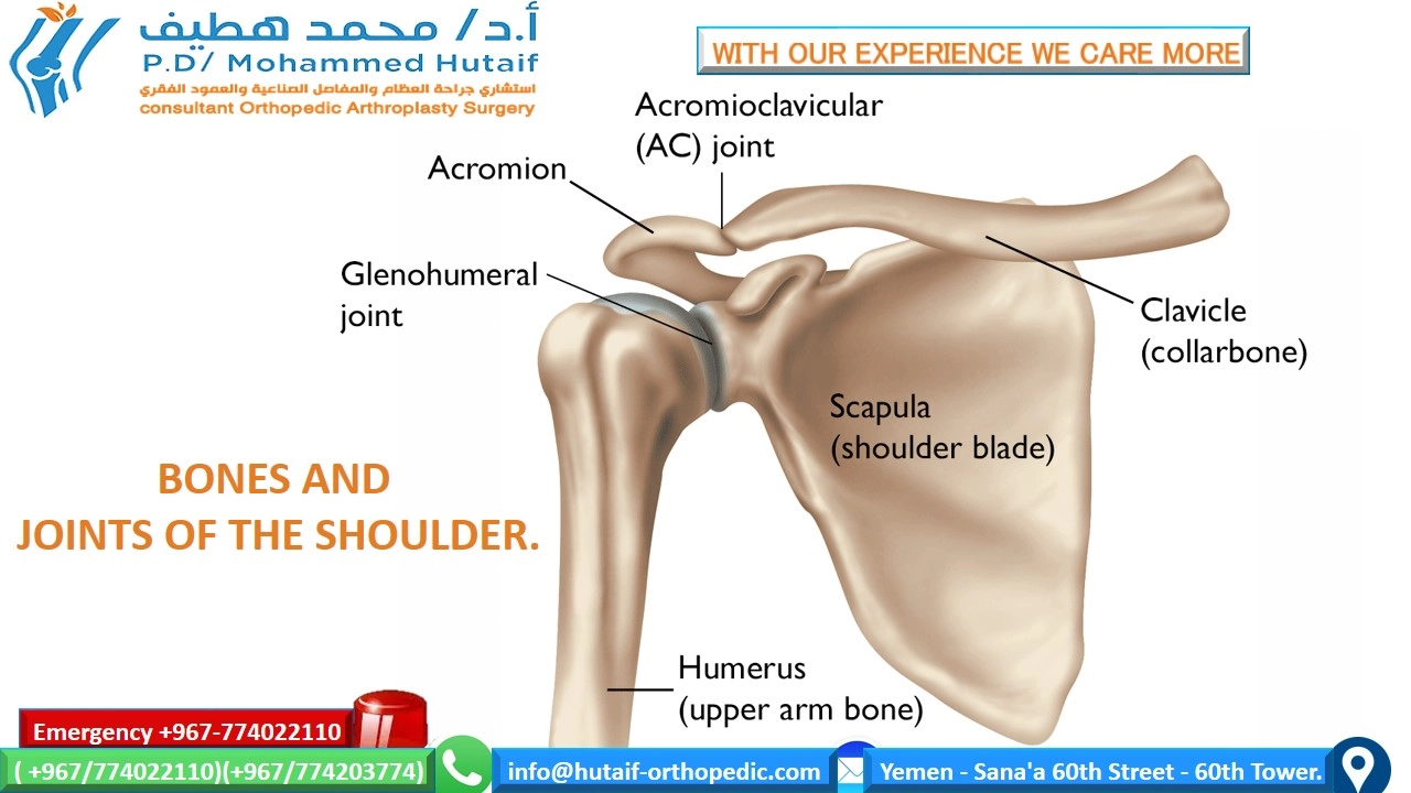 Shoulder osteoarthritis-Summary Osteoarthritis is the most common form of arthritis, affecting millions of people worldwide. It occurs when the protective cartilage that cushions the ends of the bones wears down over time.. There are two joints in the shoulder, and both may be affected by Osteoarthritis . One joint is located where the clavicle meets the tip of the shoulder blade (acromion). This is called the acromioclavicular (AC) joint. The second is where the head of the humerus fits into the scapula and is called the glenohumeral joint, however Shoulder osteoarthritis is a common name for glenohumeral osteoarthritis, a condition that involves degenerative changes to the cartilage and other structures in the glenohumeral joint. Shoulder osteoarthritis causes pain and stiffness that can make it difficult to lift your arm, brush your hair or reach up to a high shelf. Osteoarthritis symptoms can usually be managed, although the damage to joints can't be reversed  Shoulder osteoarthritis-Anatomy Your shoulder is made up of three bones:  Upper arm bone (humerus) Shoulder blade (scapula) Collarbone (clavicle) The head of your upper arm bone fits into a rounded socket in your shoulder blade. This socket is called the glenoid. A combination of muscles and tendons keeps your arm bone centered in your shoulder socket. These tissues are called the rotator cuff.  There are two joints in the shoulder, and both may be affected by arthritis. One joint is located where the clavicle meets the tip of the shoulder blade (acromion). This is called the acromioclavicular (AC) joint. The second is where the head of the humerus fits into the scapula and is called the glenohumeral joint. . To provide you with effective treatment, your doctor will need to determine which joint is affected and what type of arthritis you have.