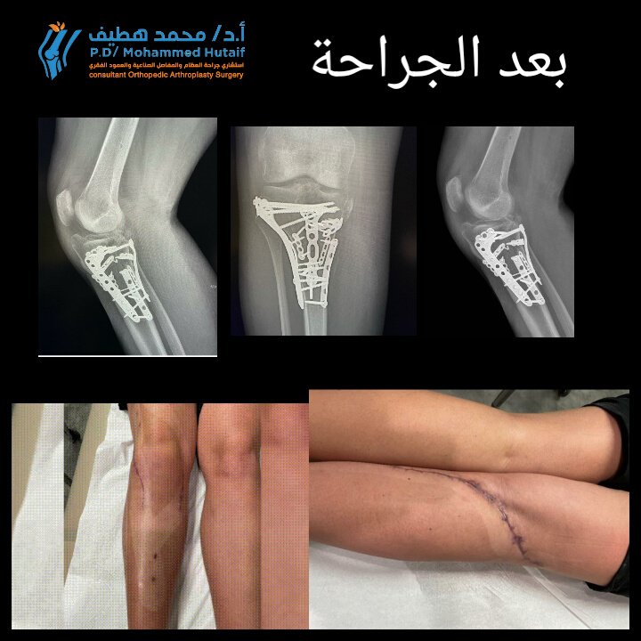 أفضل دكتور عظام