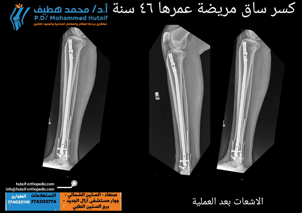 أفضل دكتور عظام 