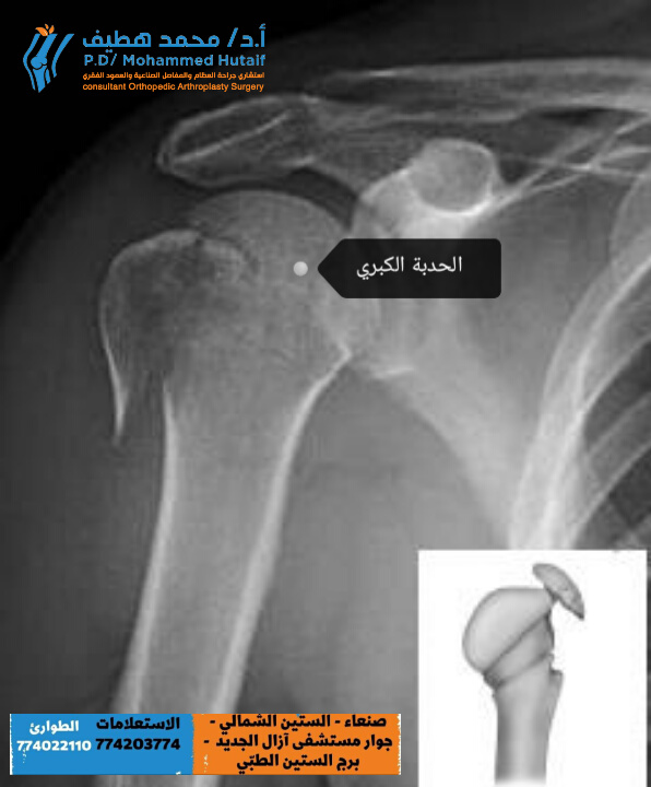 أفضل دكتور عظام