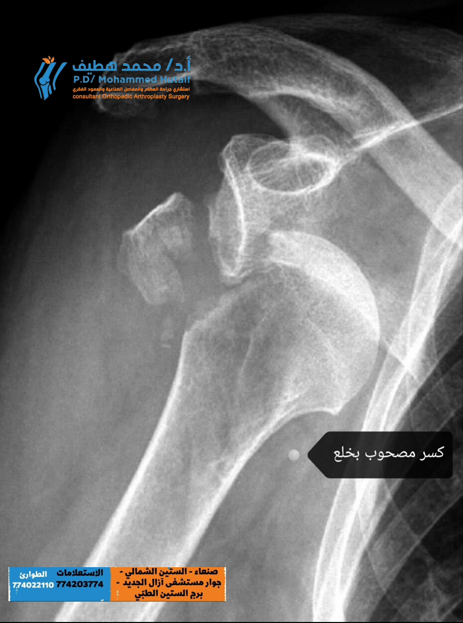 أفضل دكتور عظام