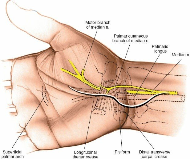 Figure 5-21 The incision for the volar approach to the wrist. The incision should be made on the ulnar side of the palmaris longus tendon to protect the palmar cutaneous branch of the median nerve.